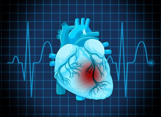 Stroke Treatment Specialist