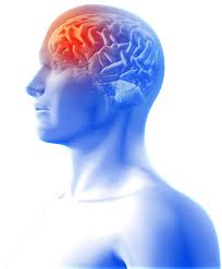 Migraine Treatment Specialist